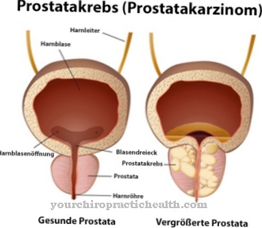 Prostatitis és szexuális funkció. A prosztata megnagyobbodás tünetei