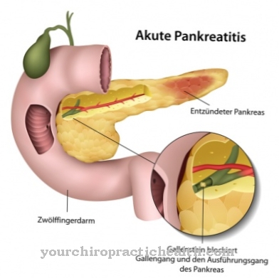 Az akut pancreatitis kezelése a 2. típusú diabéteszben