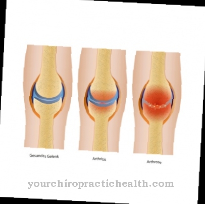 aparat pseudo artroza deteriorarea ligamentului colateral extern al articulației genunchiului