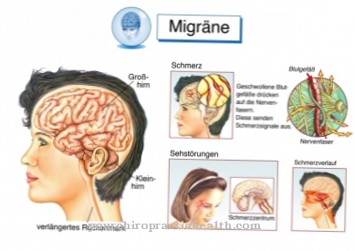 Okuláris migrén