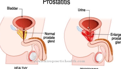 simptome de inflamație a prostatei)