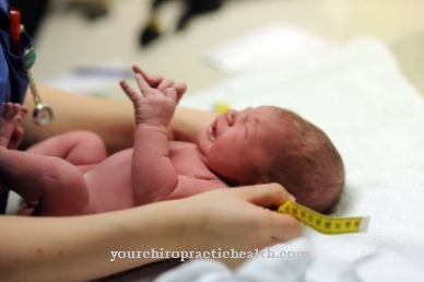 porod s visokim tlakom mjerenje pritiska bez aparata
